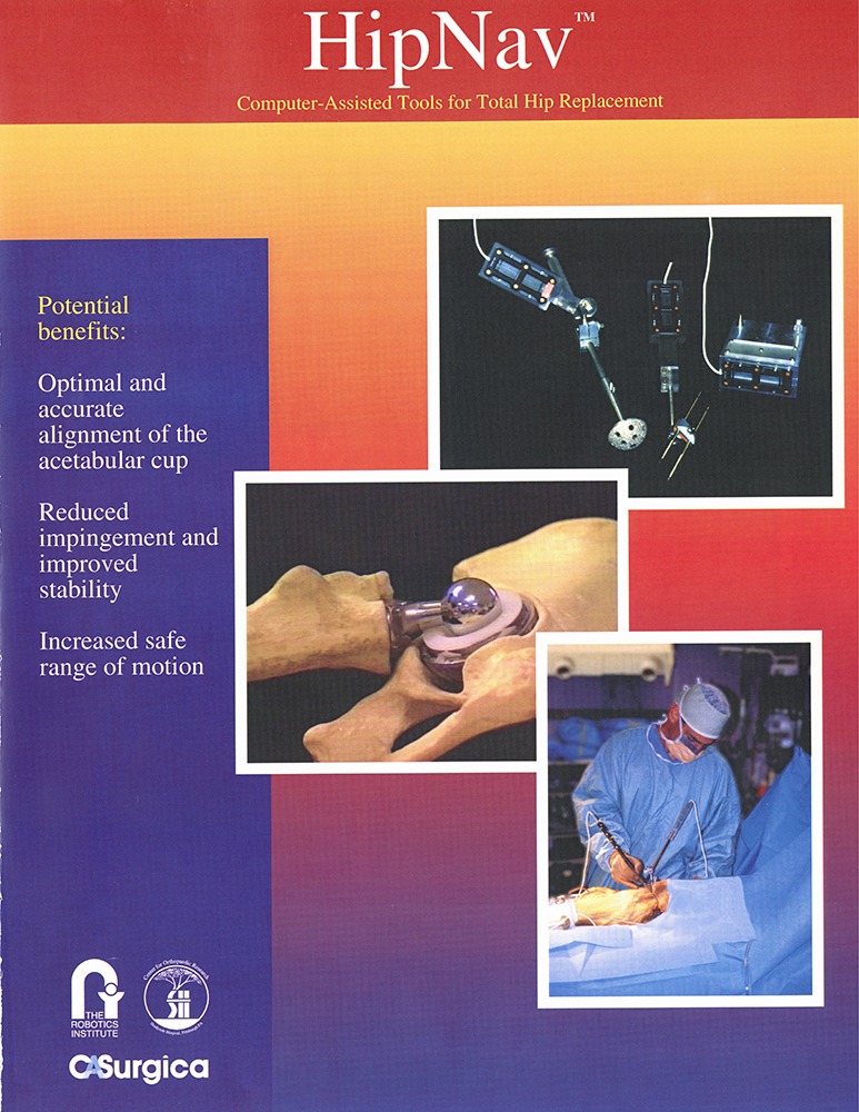 An informational brochure for the HipNav project, a computer-assisted surgical system developed by researchers at CMU in partnership with medical experts, 1998.